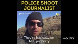RAW_ Police shoot juornalist - Dakota Pipeline Activist Shot With Rubber Bullet