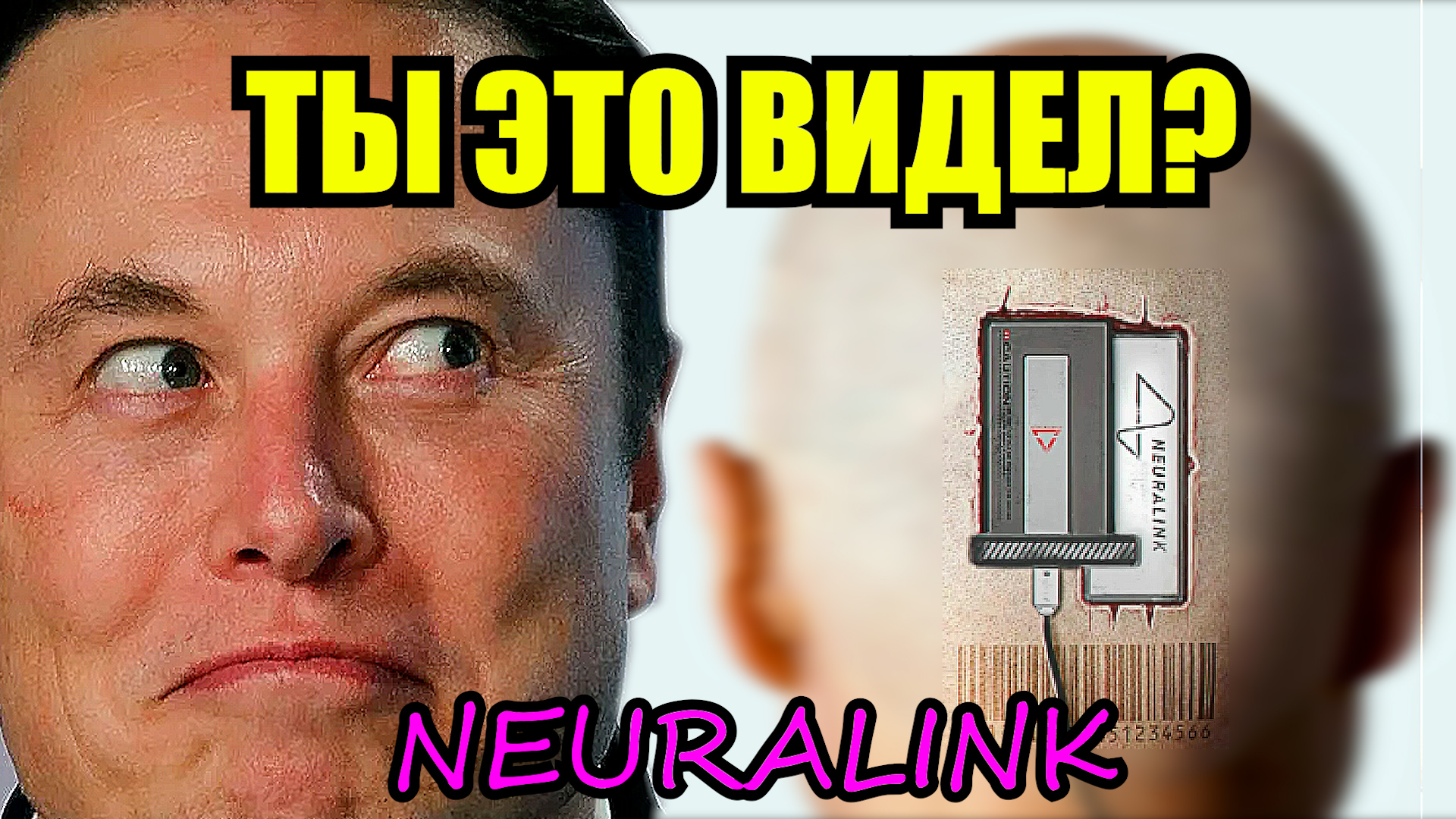 Я ВЖИВИЛ ЧИП-ИМПЛАНТ ОТ NEURALINK Ноланда Арбо
