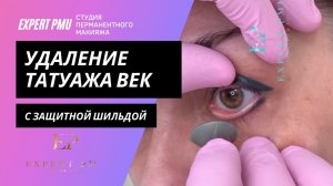 Лазерное удаление татуажа век : до и сразу после процедуры