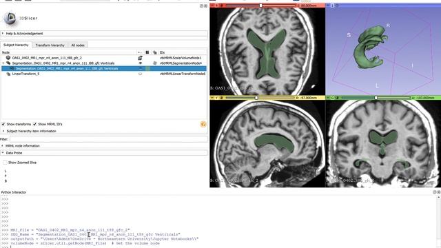 Converting Segment STL's to compressed Numpy arrays