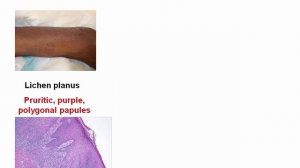 USMLE RX - 8.Анатомия - 2.Дерматология - 7.Различные Кожные Заболевания