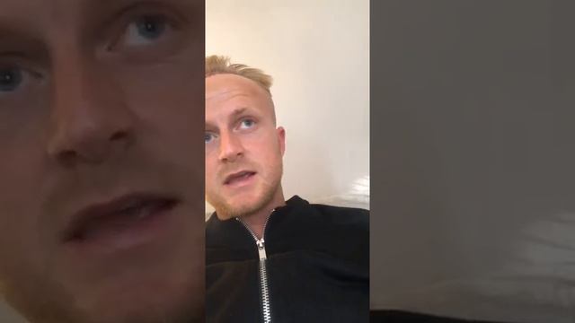 Professional footballer Ben Reeves 24 Hours After His FUE Hair Transplant