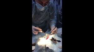 Извлечение инородных тел