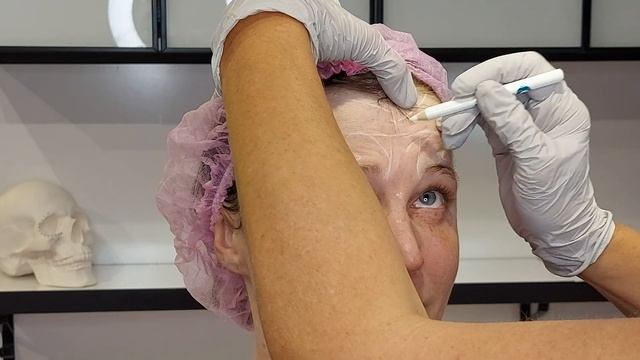 Токсин разметка. Клиент-подруга. Визит 2 р.в год. смотреть онлайн