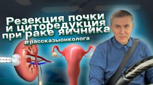 Резекция почки и циторедукция #рассказыонкологасЗСД