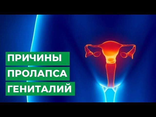 Причины пролапса гениталий