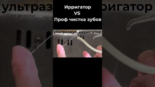 Ирригатор и ультразвук - сравнение #ольгаеременко #стоматолог