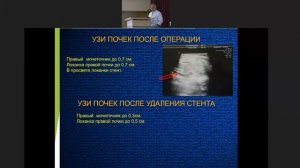 Хирургическая тактика при обструктивных уропатиях у детей