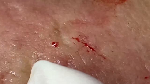 Enjoy Every Day With The Best Video Loan Nguyen Spa Official 2651 смотреть онлайн