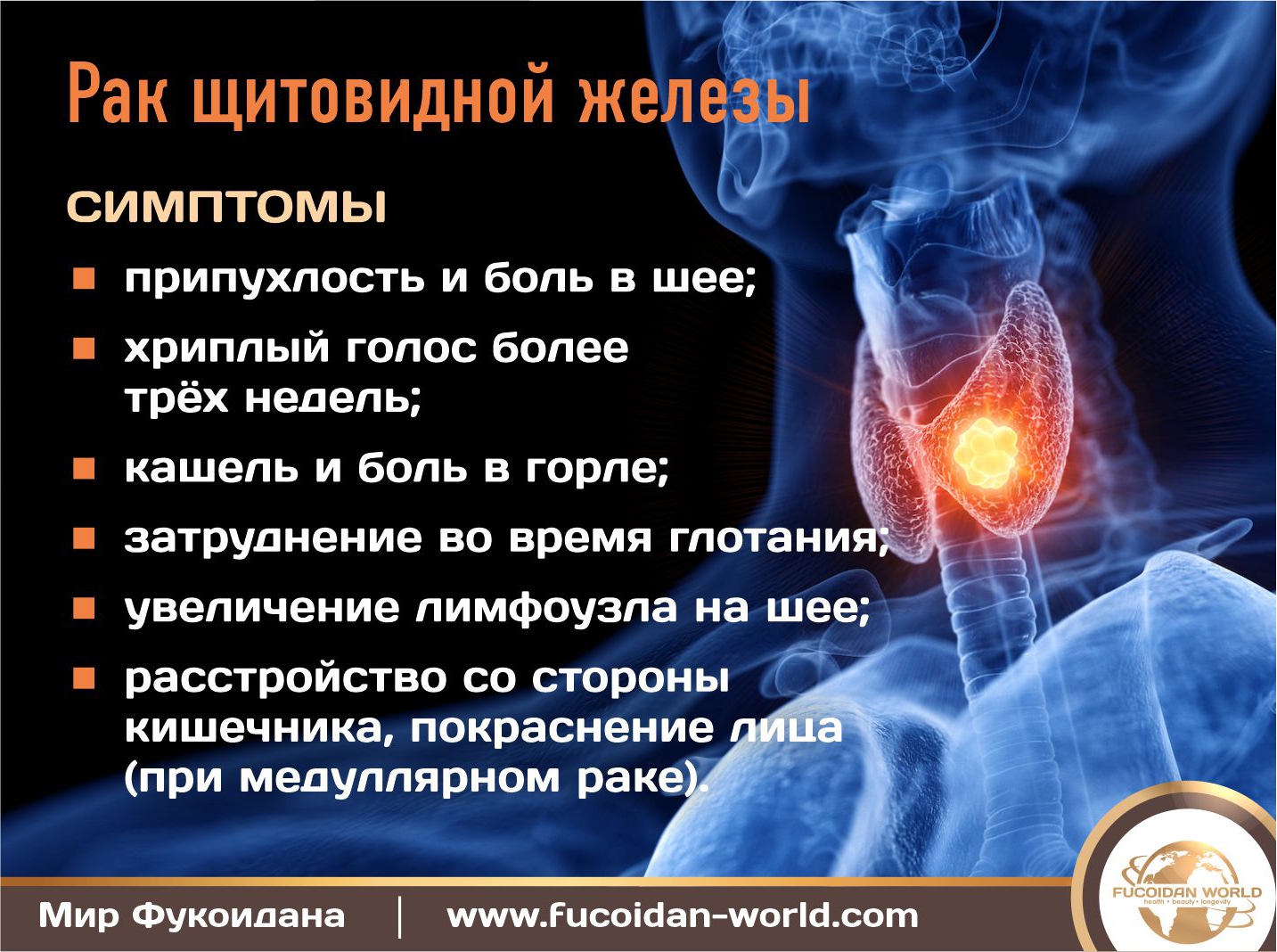 Гипотериоз, Тиреотоксикоз,  Рак щитовидной железы симптомы, профилактика  и лечеине. 2022 год