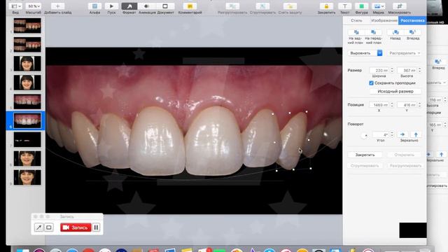DSD цифровой дизайн улыбки смотреть онлайн