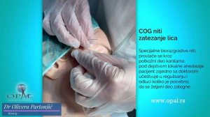 dr Olivera Partonjić -  Zatezanje lica Cog nitima