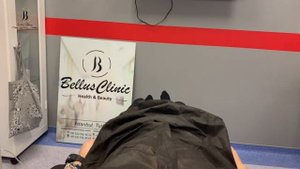 Пересадка волос до и после / видео отзыв и результат пересадки волос Алексея