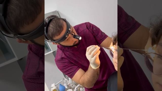 Вот что образуется в ушах. Лор-врач Эльдар Мазумович промыл уши пациентам и достал «клад» ? смотреть онлайн