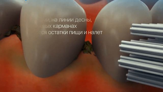 Что такое ирригатор? смотреть онлайн