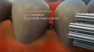 Что такое ирригатор?