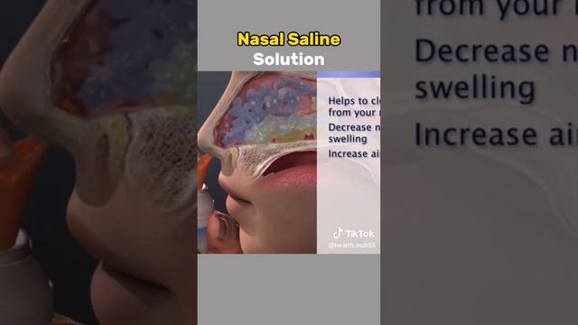 #healthtips  Nasal saline solution Medical animation 3D