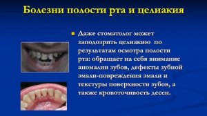 Целиакия. Детские корни взрослых проблем