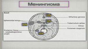 Ураження оболонок мозку  розбір клінічних спостережень