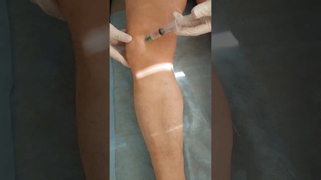 Сертобек про внутрисуставно смотреть онлайн