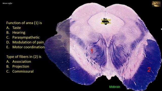 Picture Test in Neuroanatomy Brain Sections 5
