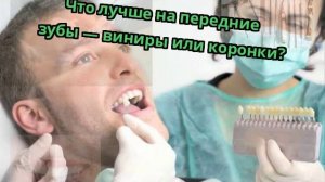 Что лучше на передние зубы — виниры или коронки?