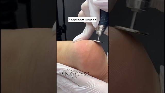 Полировка пяток . Масло для кожи и ногтей 1530 р #педикюр#курсыпедикюра#ноги#пятки #трещинынапятках