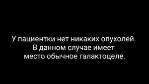 ИЗ ПРАКТИКИ #1. ГАЛАКТОЦЕЛЕ.