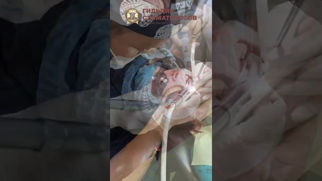 Профессиональная чистка зубов после протезирования на имплантатах у стоматолога-ортопеда. Часть 1