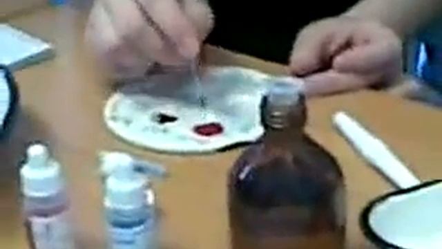 Определение группы крови цоликлонами Есть ошибки смотреть онлайн