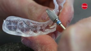 Изготовление окклюзионных шин из пластин Kombiplast и Drufosoft pro