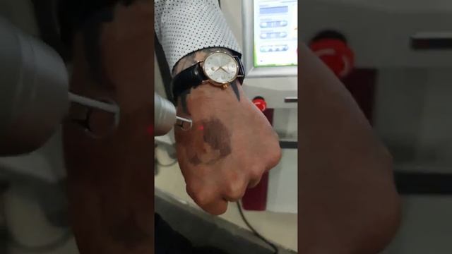 Косметологическая платформа NDYAG от компании RUIKD (Юж. Корея) смотреть онлайн