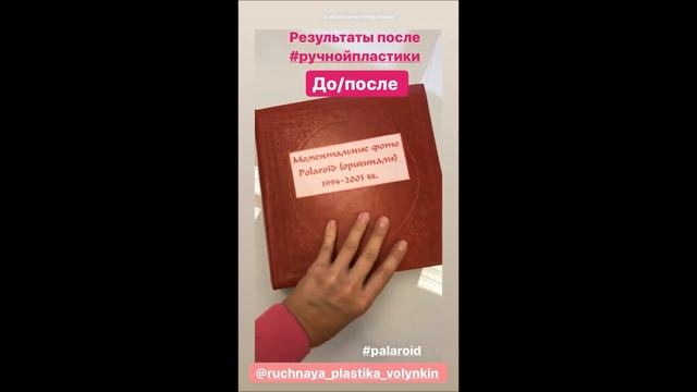 Поля Поляковав Центре Ручная Пластика / ручная пластика тела