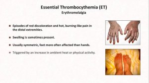 Thrombocytosis: Hemostasis - Lesson 9