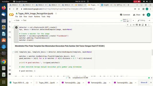Demo : Image Recognition | Brain Tumor (Hemangioblastoma) Detection Using Template Matching OpenCV2