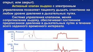 Режимы ИВЛ 8. BIPAP APRV BiLevel и др.