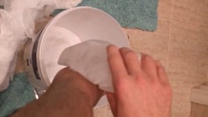 Двухлодыжечный перелом: Снятие гипса (День 3)