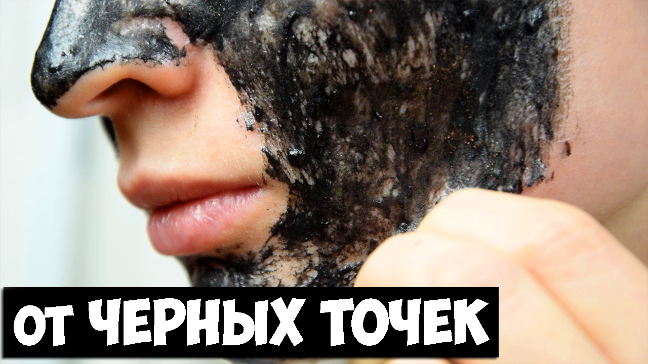 От черных точек не осталось и следа - Черная маска от черных точек, доступный рецепт