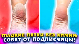 Пяточки как у "Принцессы" без ванночек, нашатыря! Два ингредиента и стопы без натоптышей и трещин!