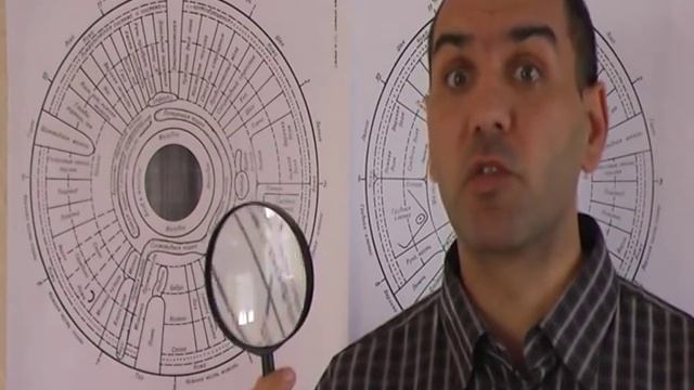 ИРИДОДИАГНОСТИКА смотреть онлайн