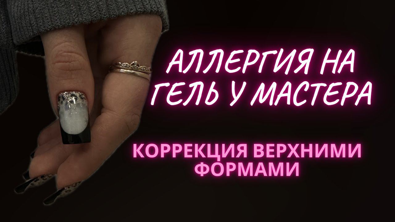 Аллергия на материал у мастера маникюра! Коррекция верхние формы!