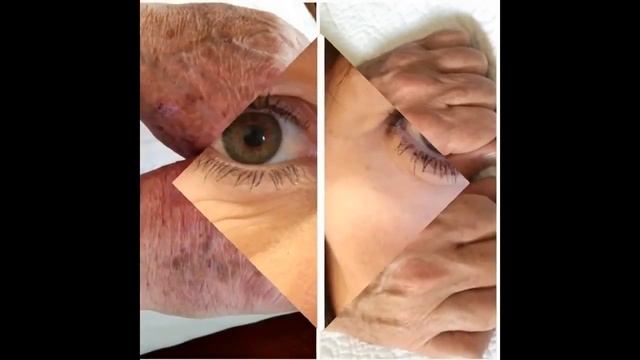 NERIUM RESULTADOS ANTES Y DESPUES смотреть онлайн