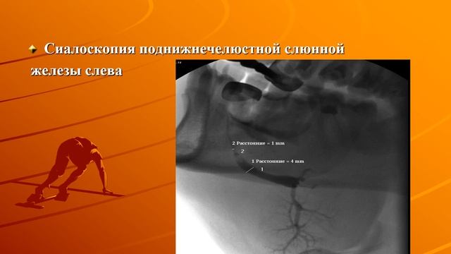 Методы исследования слюнных желёз