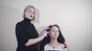 техника инъекций в височную зону