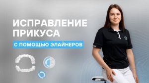 Исправление прикуса с помощью элайнеров | Стоматология Руссдент