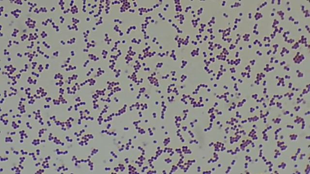 Klebsiella,Staphylococcus,E coli, Candida,Acinetobacter,Bacillus in Gram stain Under the Microscop смотреть онлайн