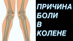 САМАЯ ЧАСТАЯ ПРИЧИНА БОЛИ В КОЛЕНЕ | Динамический Вальгус
