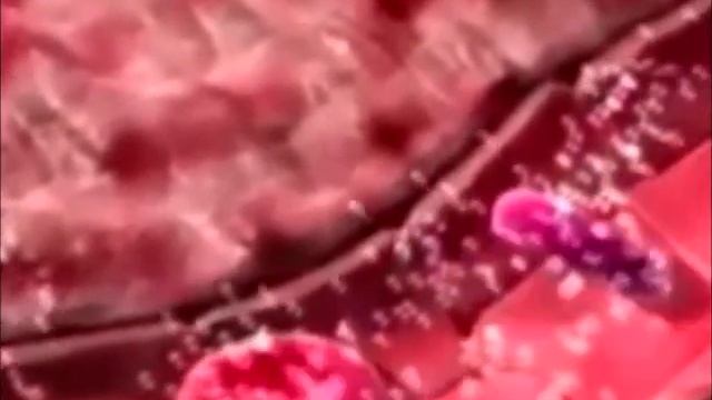Постреанимационная болезнь патофизиология