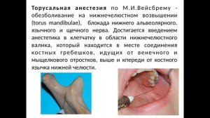 Лекция:Проводниковая анестезия.
