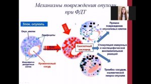«Фотодинамическая терапия в онкологии»